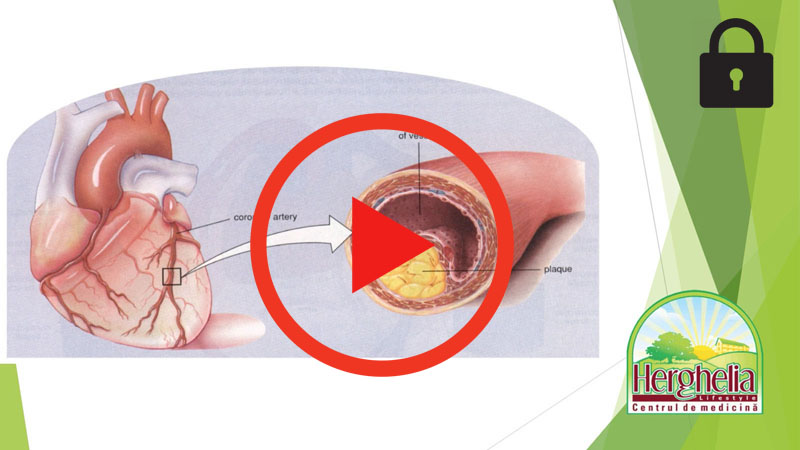 3. Hogyan Vedjuk Az Arteriakat_DiaVazlat_playlocked